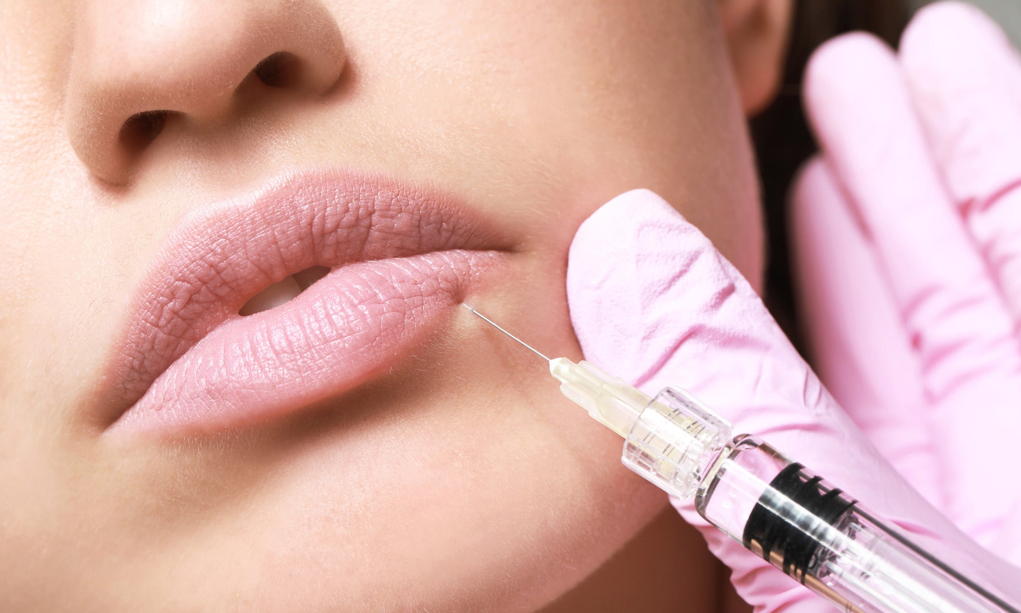 woman with perfect pouty lip getting lip injections
