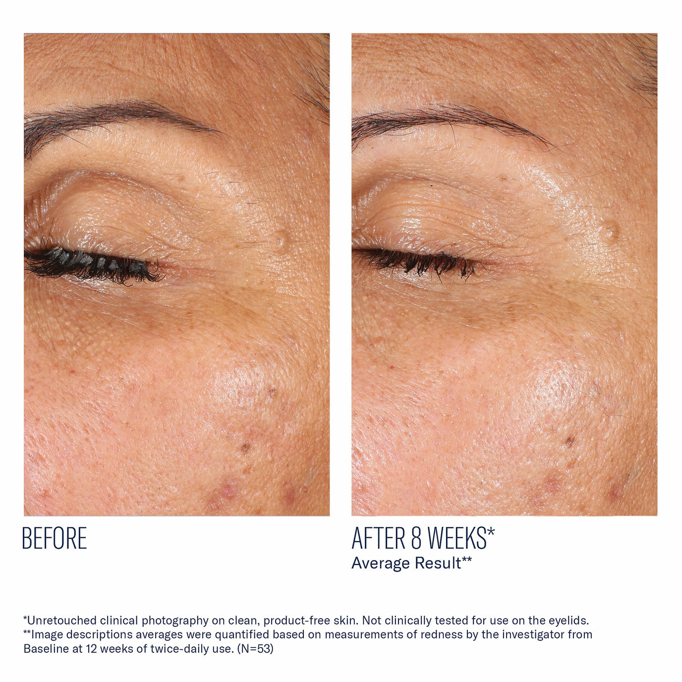 EyeMax AlphaRet Overnight Cream - Skinbetter Science