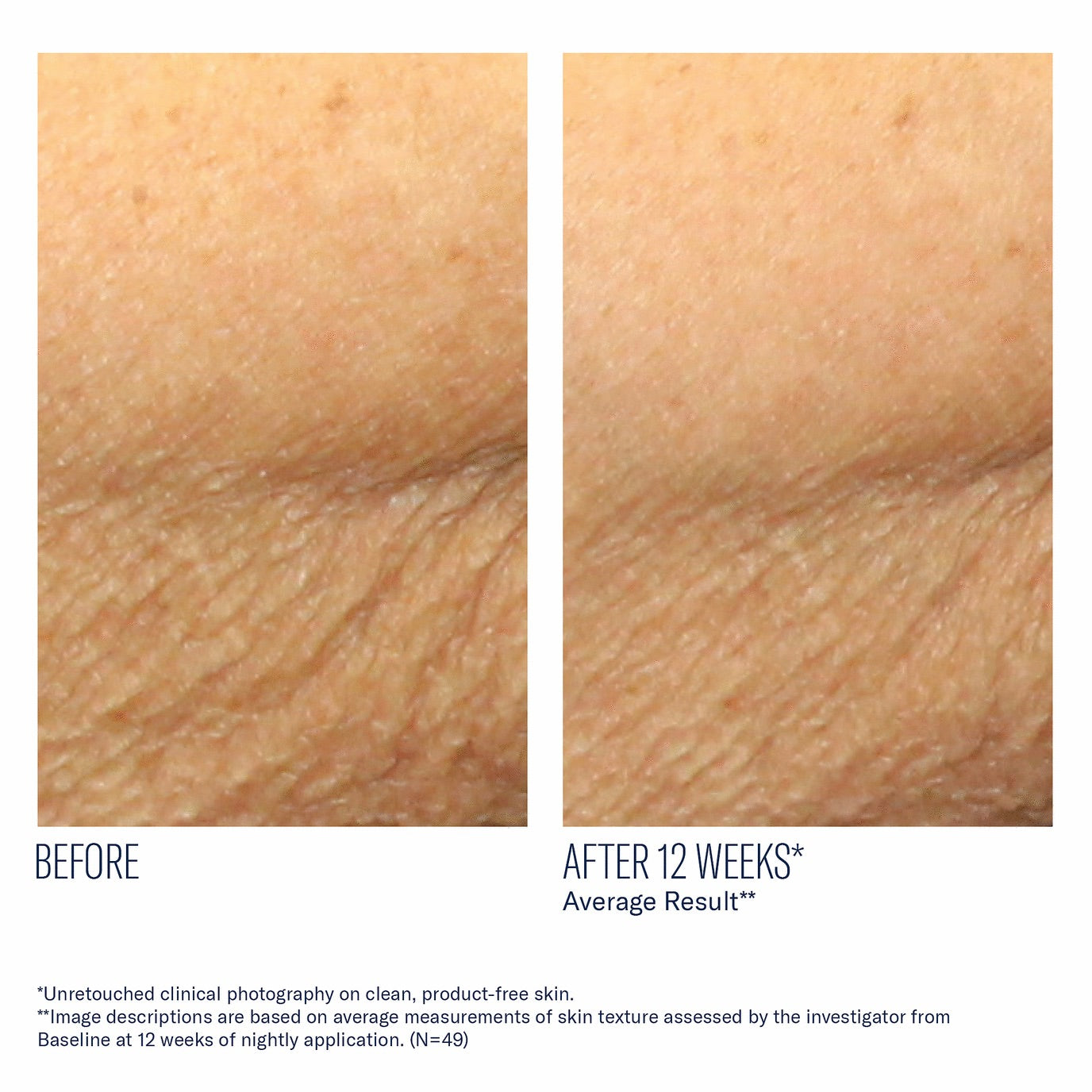 AlphaRet Body Overnight Cream - Skinbetter Science