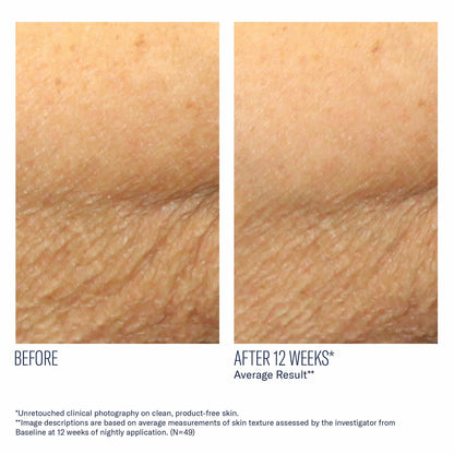 AlphaRet Body Overnight Cream - Skinbetter Science