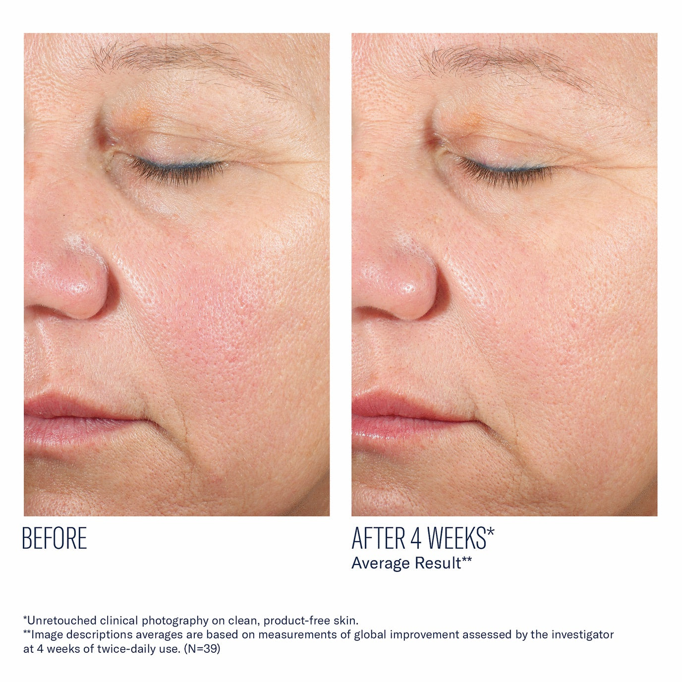 Alto Advanced Defense and Repair Serum - Skinbetter Science