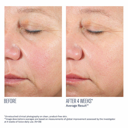 Alto Advanced Defense and Repair Serum - Skinbetter Science