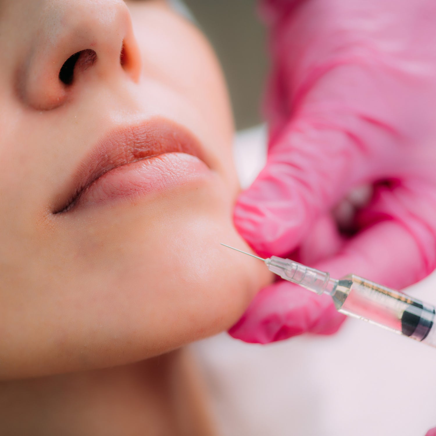 needle with dermal filler being injected in chin