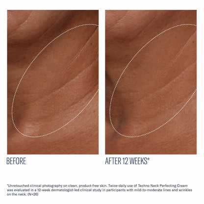 Techno Neck Perfecting Cream - Skinbetter Science