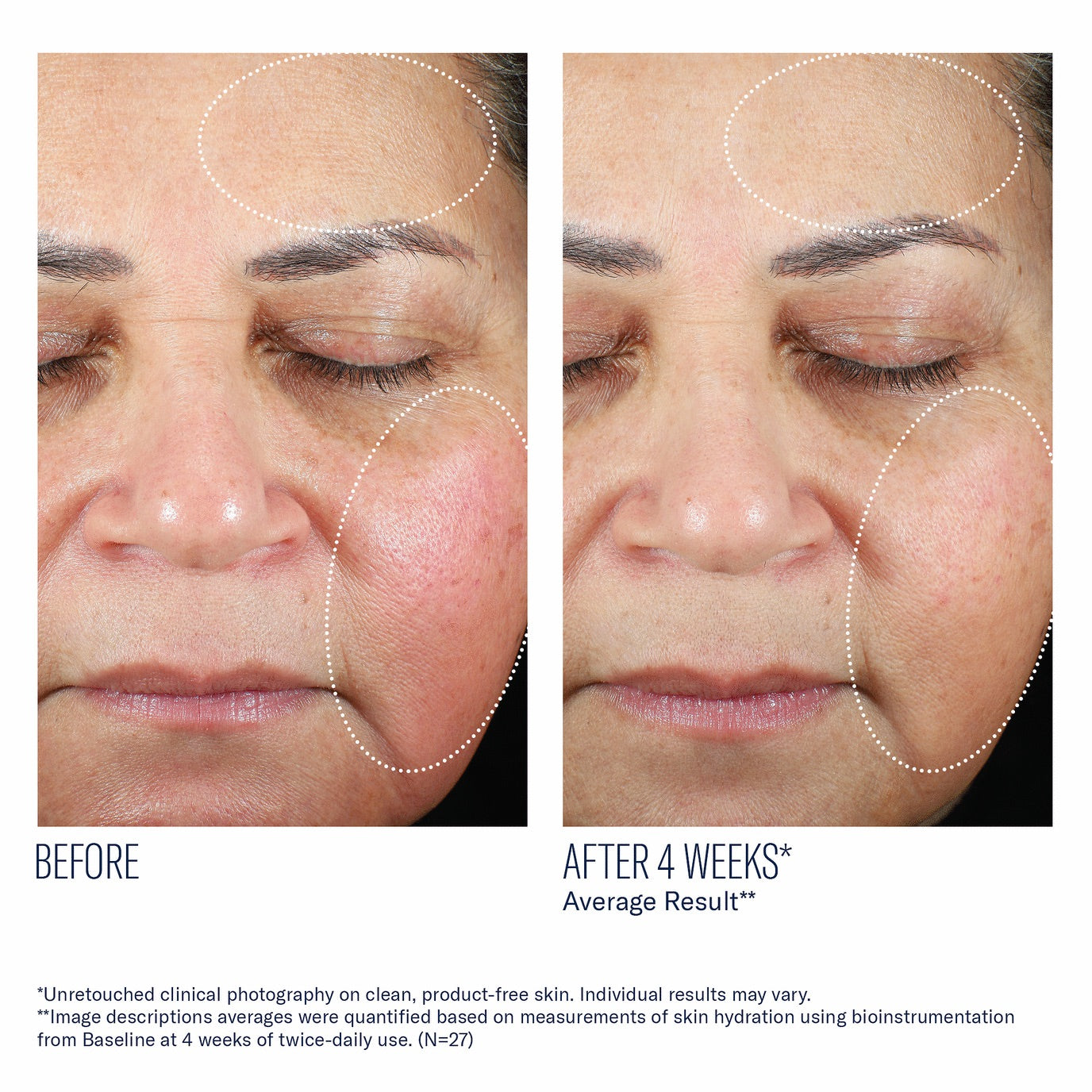 Trio Luxe Moisture Treatment - Skinbetter Science