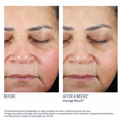 Trio Luxe Moisture Treatment - Skinbetter Science